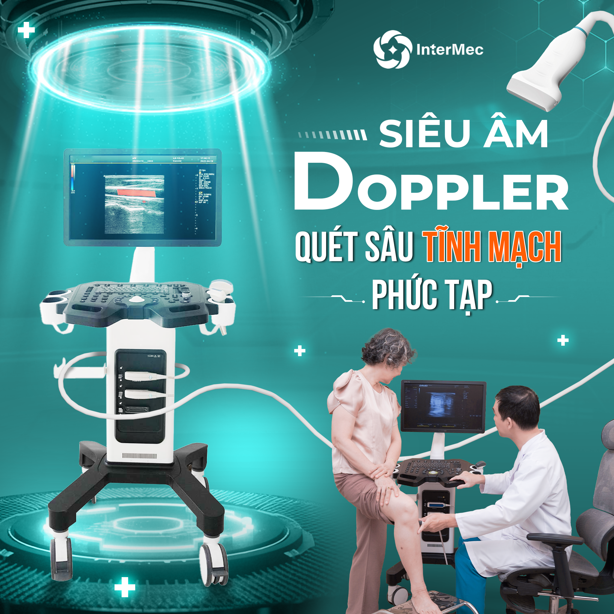 siêu âm Doppler