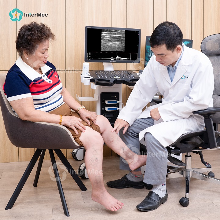 Khám giãn tĩnh mạch