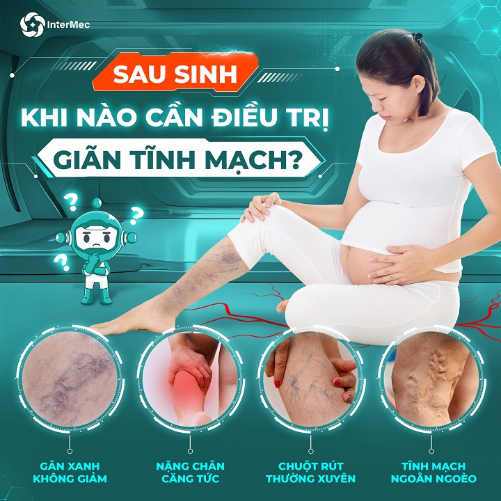 phụ nữ sau sinh dễ bị giãn tĩnh mạch