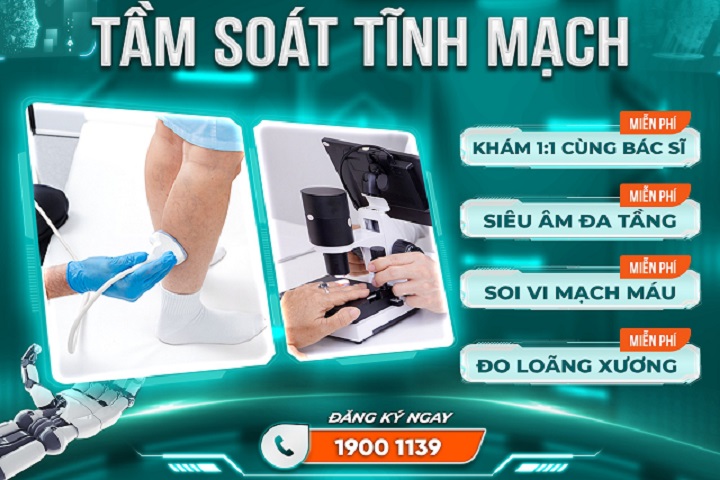 quy trình điều trị giãn tĩnh mạch