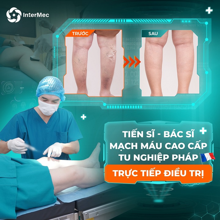 bác sĩ tĩnh mạch